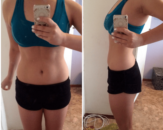 Keto-Diät vor und nach Fotos
