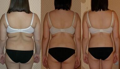 Möglichkeiten, 7 kg in einer Woche zu verlieren